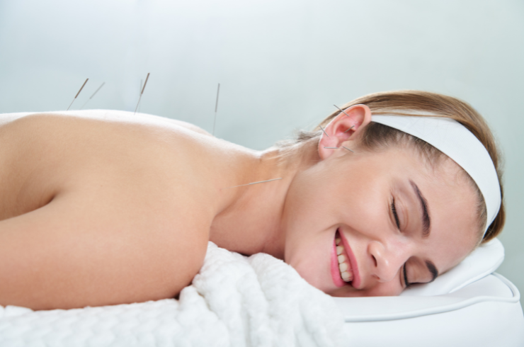 Dry Needling Therapy